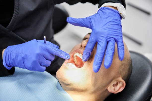 Best Urgent Care for Lost Fillings or Crowns in Flora, IL