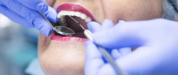 Best Emergency Tooth Extraction in Flora, IL